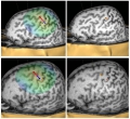 Brain cortical surface mapped during experiment